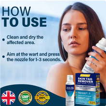 Load image into Gallery viewer, TagRecede Cryo Treatment Spray