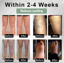 Load image into Gallery viewer, ATTDX® FlowBoost Edema Drain Herbal Roll On