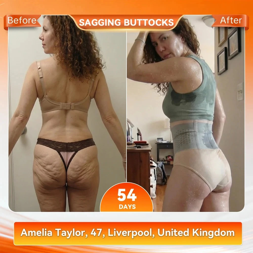 ThermoSculpt Fat-Burn Shaper Shorts