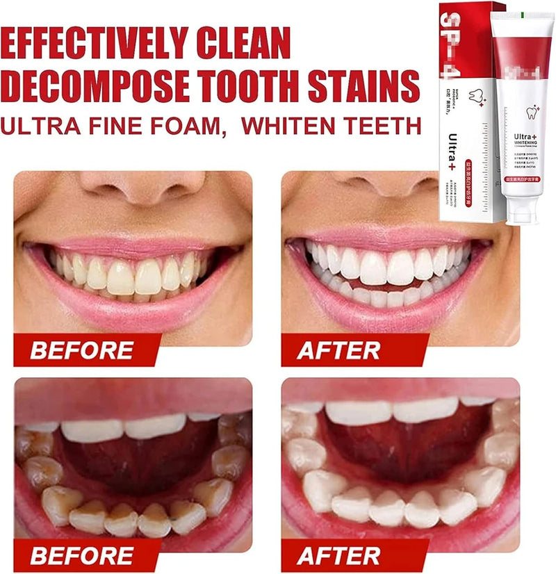 SP-4 Probiotic Whitening Toothpaste