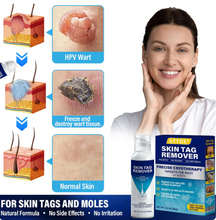 Load image into Gallery viewer, TagRecede Cryo Treatment Spray
