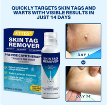 Load image into Gallery viewer, TagRecede Cryo Treatment Spray
